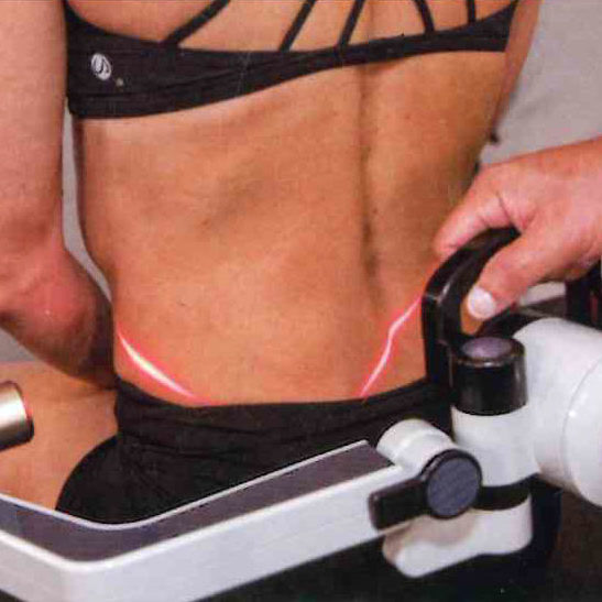Low Level Laser Therapy (LLLT) treatment