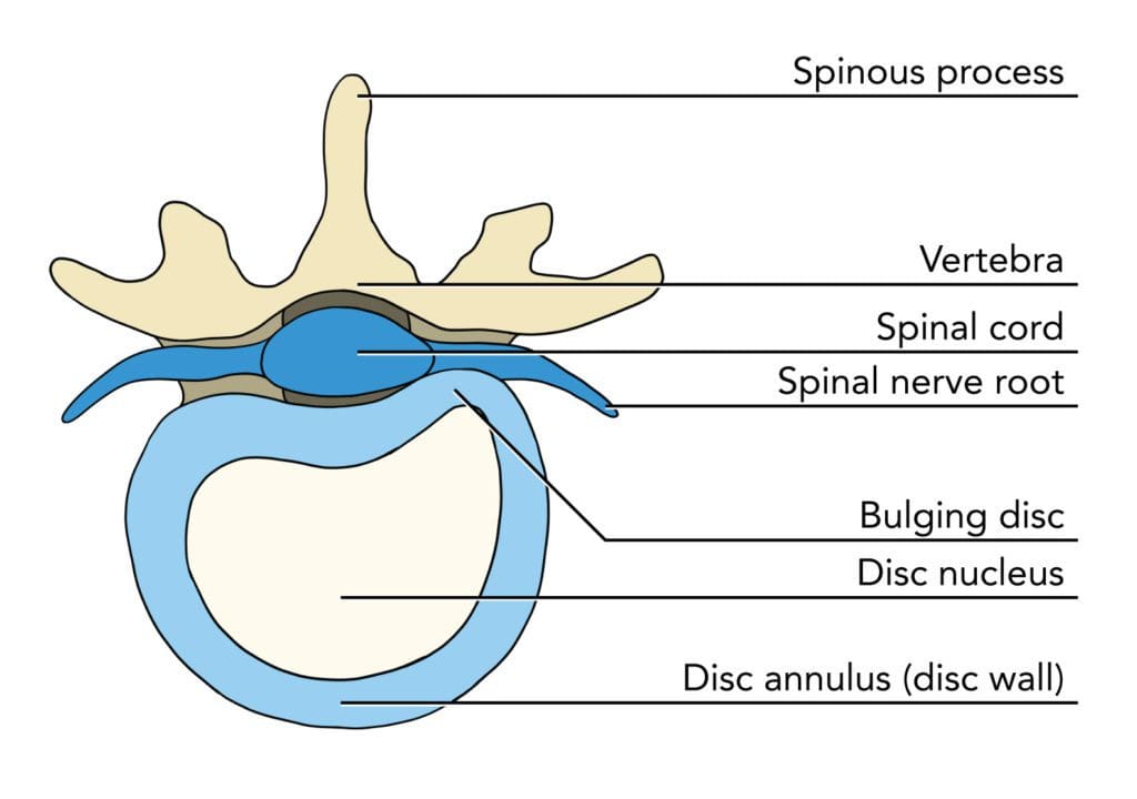 top view of vertebra showing parts of spine